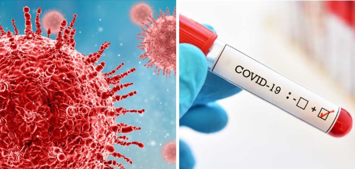 Two COVID-19-Positive Patients Die at Mumbai’s KEM Hospital; BMC Cites Comorbidities